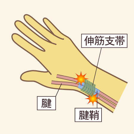 腱、腱鞘、伸筋支帯